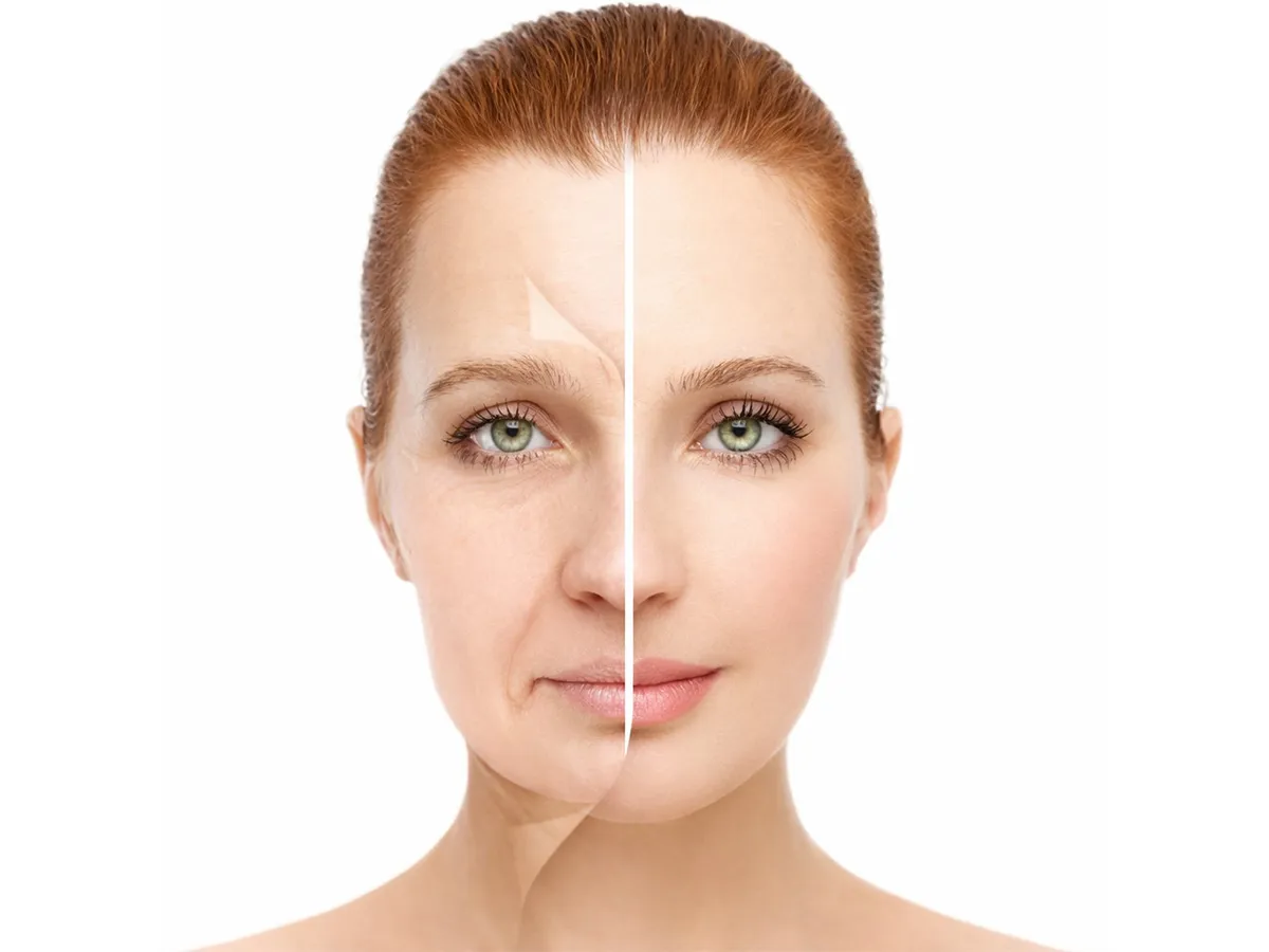 Yüz Dolgusu - Görsel 1